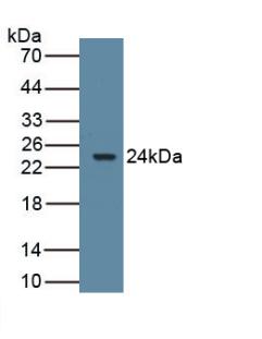 Polyclonal Antibody to Aromatase (ARO)