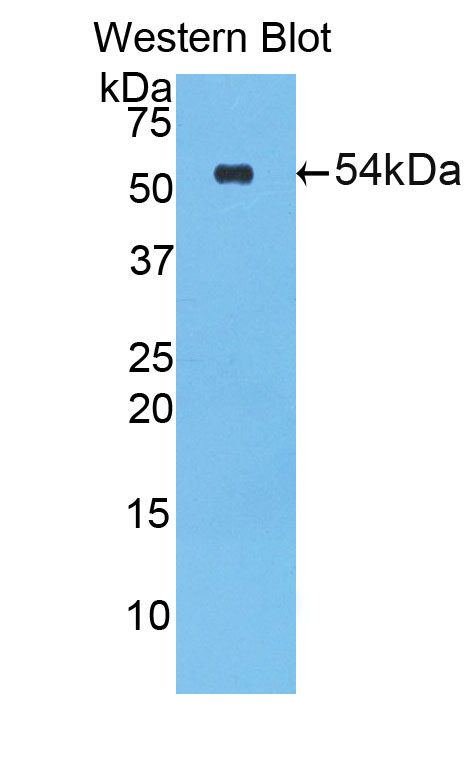 Biotin-Linked Polyclonal Antibody to Lipase, Bile Salt Dependent (BSDL)
