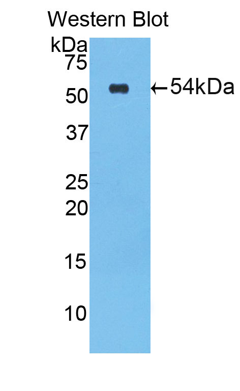 PAC342Hu71.jpg