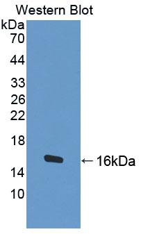 Polyclonal Antibody to Butyrylcholinesterase (BCHE)