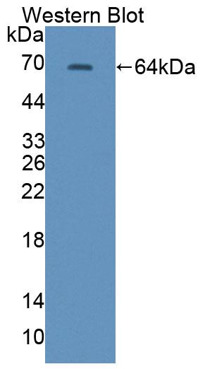 Polyclonal Antibody to Calcineurin Binding Protein 1 (CABIN1)