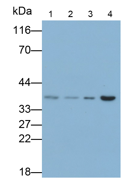 PAC356Hu01.jpg