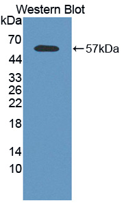 Polyclonal Antibody to Calpain 2 (CAPN2)