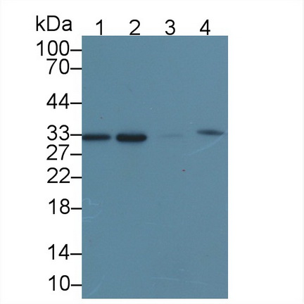 Polyclonal Antibody to Carbonyl Reductase 1 (CBR1)