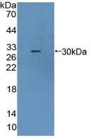 Polyclonal Antibody to Carbonyl Reductase 1 (CBR1)