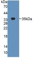 Polyclonal Antibody to Carboxylesterase 1 (CES1)