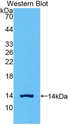 Polyclonal Antibody to Chorionic Gonadotropin Beta Polypeptide 1 (CGb1)