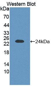 Polyclonal Antibody to Chondrolectin (CHODL)