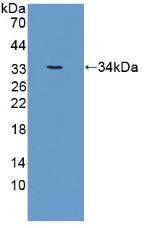 Polyclonal Antibody to Carnitine Acetyltransferase (CRAT)