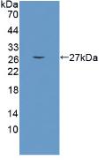 Polyclonal Antibody to Carnitine Acetyltransferase (CRAT)