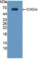 Polyclonal Antibody to Corticotropin Releasing Hormone Binding Protein (CRHBP)