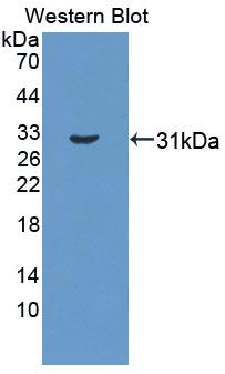 Polyclonal Antibody to C-Terminal Binding Protein 1 (CTBP1)