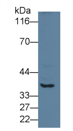 PAC410Hu01.jpg