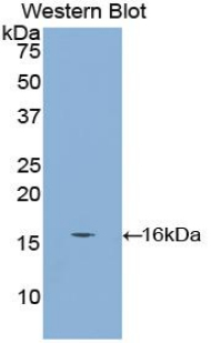 Polyclonal Antibody to Cubilin (CUBN)