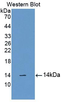 Polyclonal Antibody to Cubilin (CUBN)