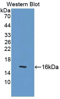 Polyclonal Antibody to Cubilin (CUBN)