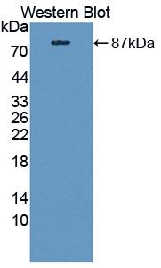 Polyclonal Antibody to Carnitine Palmitoyltransferase 2, Mitochondrial (CPT2)