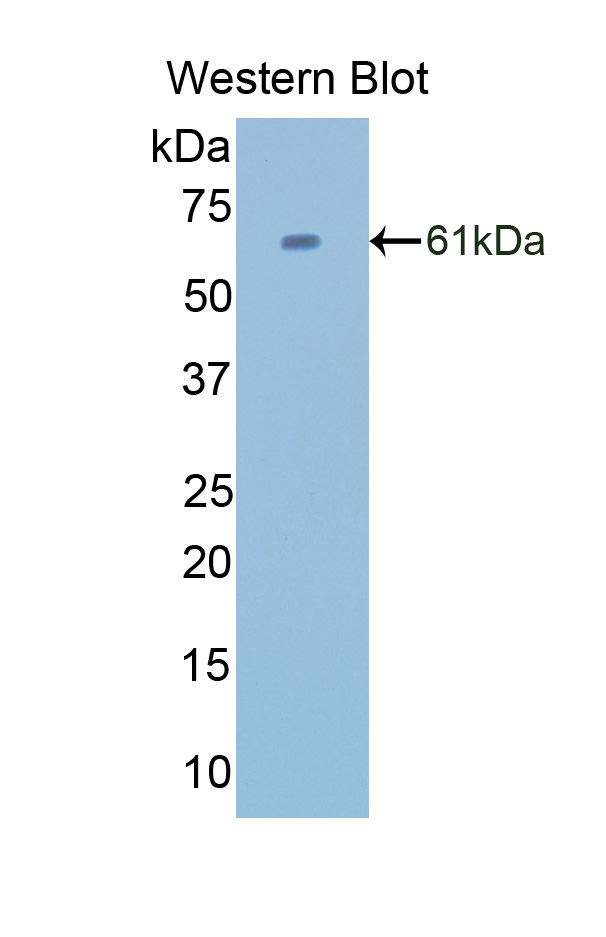 PAC418Hu02.jpg