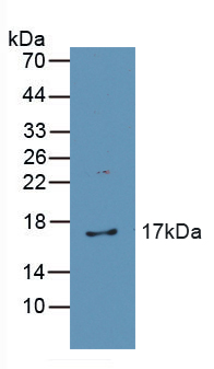 Polyclonal Antibody to Catalase (CAT)