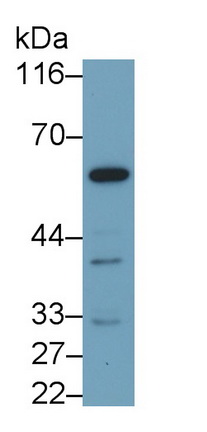 PAC418Hu05.jpg