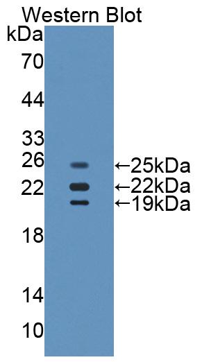 PAC418Hu71.jpg