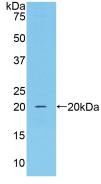Polyclonal Antibody to Catalase (CAT)