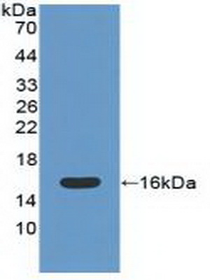 Polyclonal Antibody to Catalase (CAT)