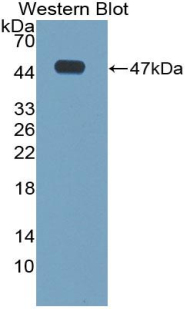 Polyclonal Antibody to Cathelicidin Antimicrobial Peptide (CAMP)