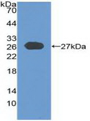 Polyclonal Antibody to Cylindromatosis (CYLD)