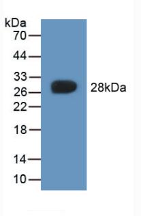 Polyclonal Antibody to Cytoglobin (CYGB)