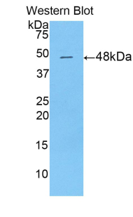 Polyclonal Antibody to Dermatopontin (DPT)