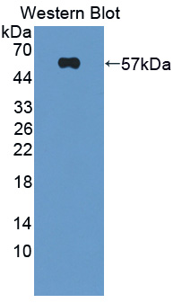 Polyclonal Antibody to Dysferlin (DYSF)