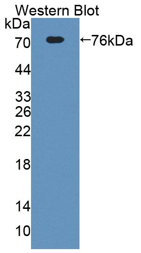 Polyclonal Antibody to Extracellular Matrix Protein 1 (ECM1)