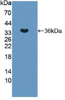 Polyclonal Antibody to Endoplasmic Reticulum To Nucleus Signalling 1 (ERN1)