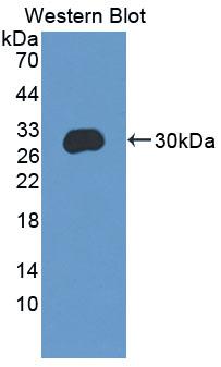 Polyclonal Antibody to CCAAT/Enhancer Binding Protein Delta (CEBPd)