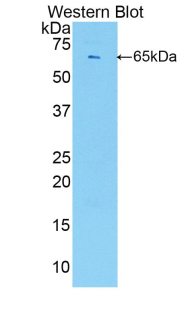 Polyclonal Antibody to Endothelial Cell Specific Molecule 1 (ESM1)