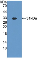 Polyclonal Antibody to Exonuclease 1 (EXO1)