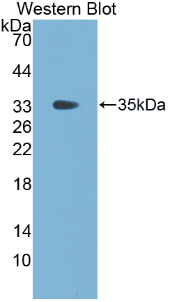 Polyclonal Antibody to Fibrinogen Gamma (FGg)