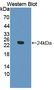 Polyclonal Antibody to Frataxin (FXN)