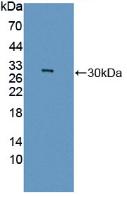Polyclonal Antibody to Guanidinoacetate-N-Methyltransferase (GAMT)
