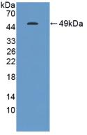 Polyclonal Antibody to Gastrokine 1 (GKN1)