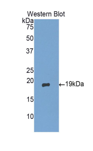 Polyclonal Antibody to Gastrokine 1 (GKN1)