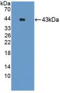Polyclonal Antibody to Gastrin Releasing Peptide Receptor (GRPR)