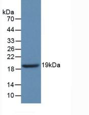 Polyclonal Antibody to Glucocerebrosidase (GBA)