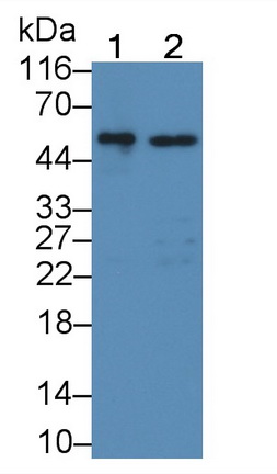 Polyclonal Antibody to Glucocerebrosidase (GBA)