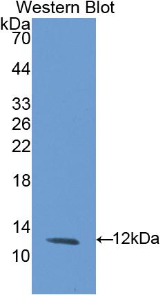 Biotin-Linked Polyclonal Antibody to Glucocerebrosidase (GBA)