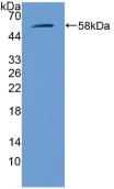 Polyclonal Antibody to Glucocerebrosidase (GBA)