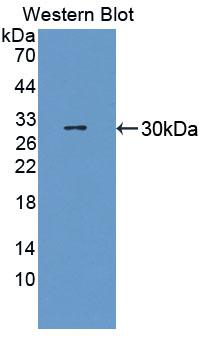 Polyclonal Antibody to Heart And Neural Crest Derivatives Expressed Protein 1 (HAND1)