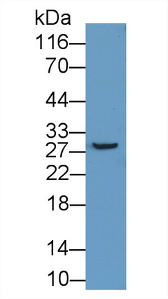 Polyclonal Antibody to ATP Binding Cassette Transporter A12 (ABCA12)