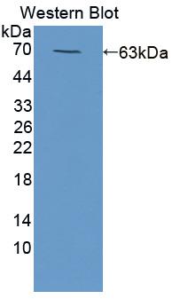 Polyclonal Antibody to Hemopoietic Cell Kinase (HCK)